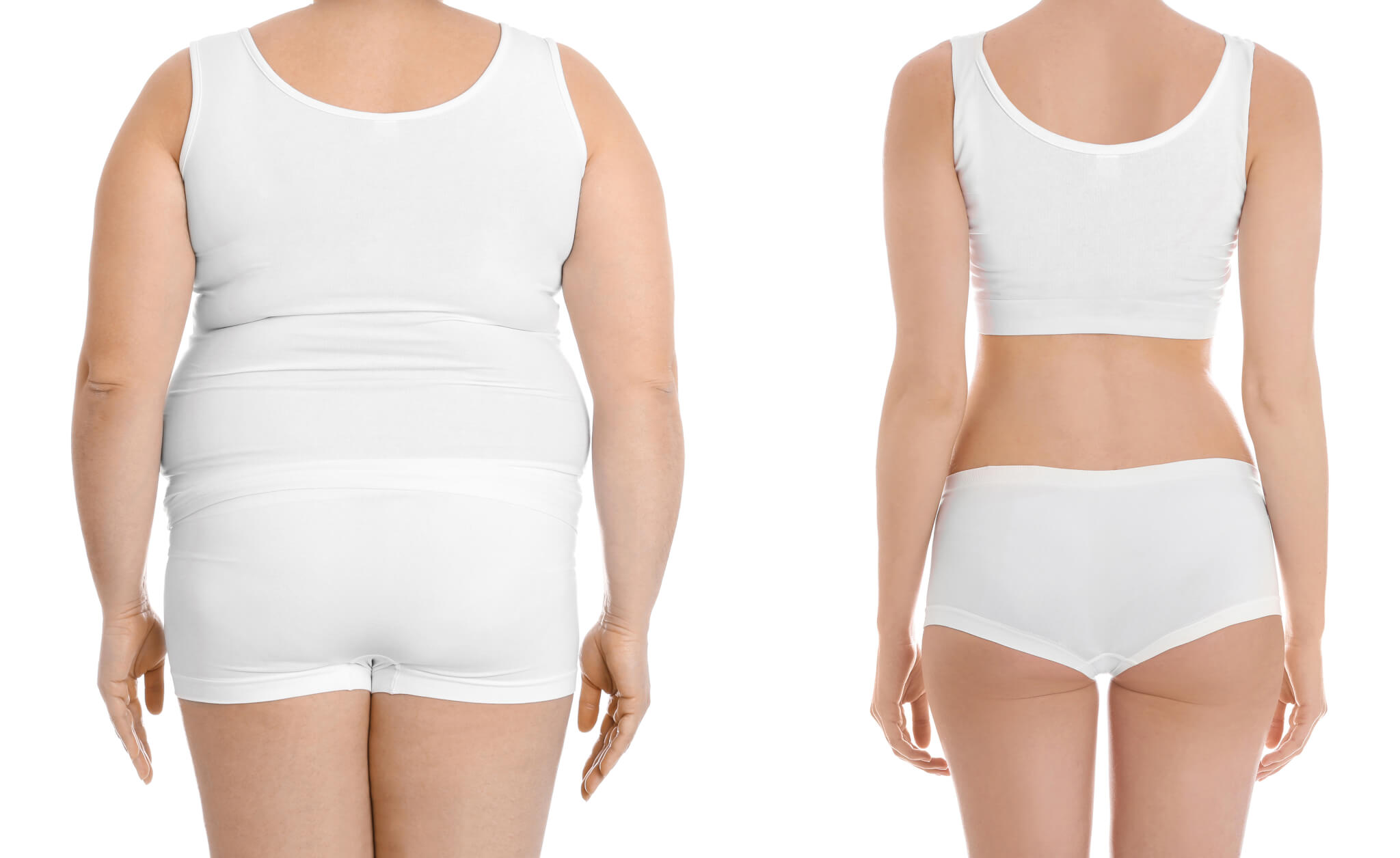 Is Liposuction Permanent